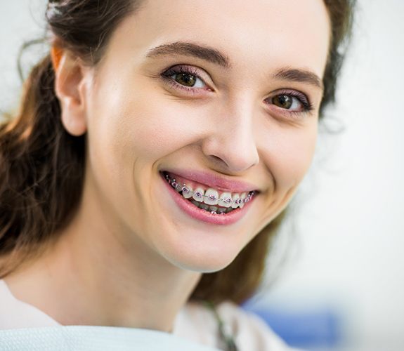 Woman smiling with braces in Sycamore, IL