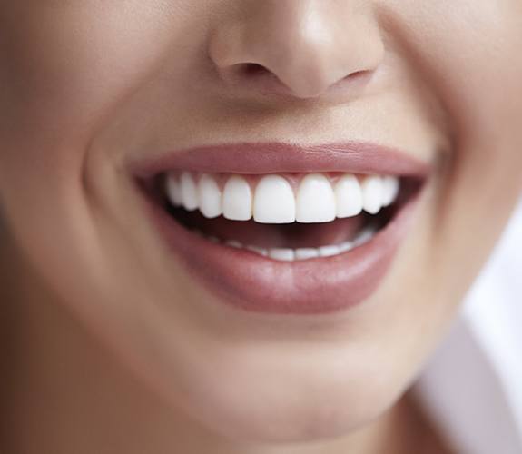 Flawless smile after metal free dental restorations