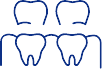 Animated dental implant supported fixed bridge placement