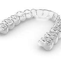 Close-up of single aligner for Invisalign in Sycamore, IL