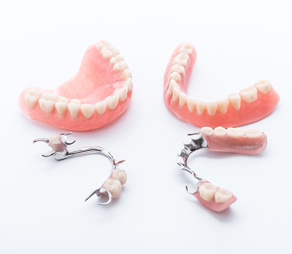 Four types of dentures