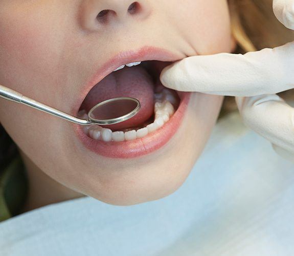 Little boy smiling at dentist after pulp therapy