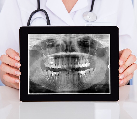 Panoramic digital dental x-rays on tablet computer
