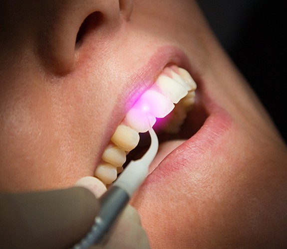 Patient receiving soft tissue laser dentistry treatment