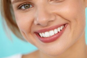 Closeup of woman with a beautiful, healthy smile and veneers in Sycamore